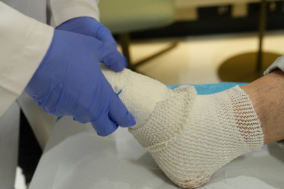 Şekerden parmağı kesilen Türkmenoğlu; ‘Biraz daha geç kalsaydım ayağımı kaybedecektim’